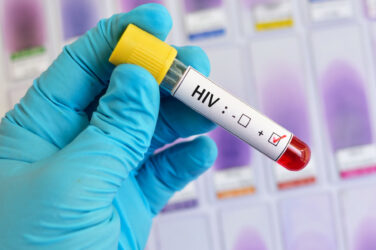 Myths and facts: HIV