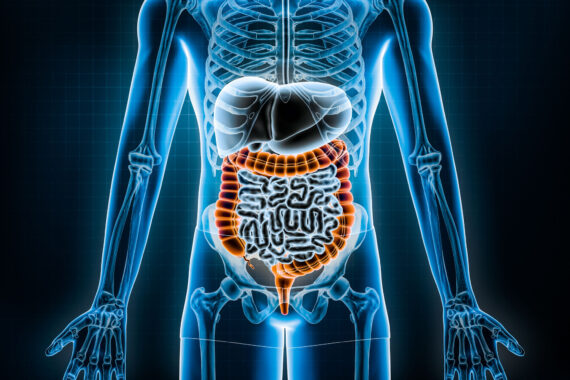 Myths and facts: Irritable bowel syndrome