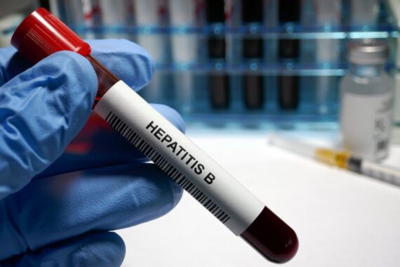 UKHSA wants to increase hepatitis B awareness among GPs